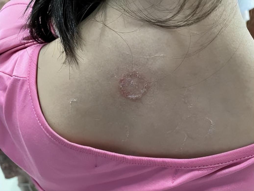 尤卓爾軟膏價格大解密，重磅揭秘真實價格??